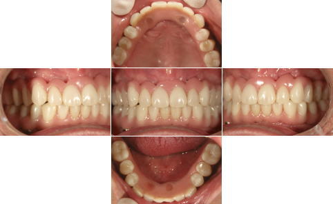 All-on-4��̑g�摜